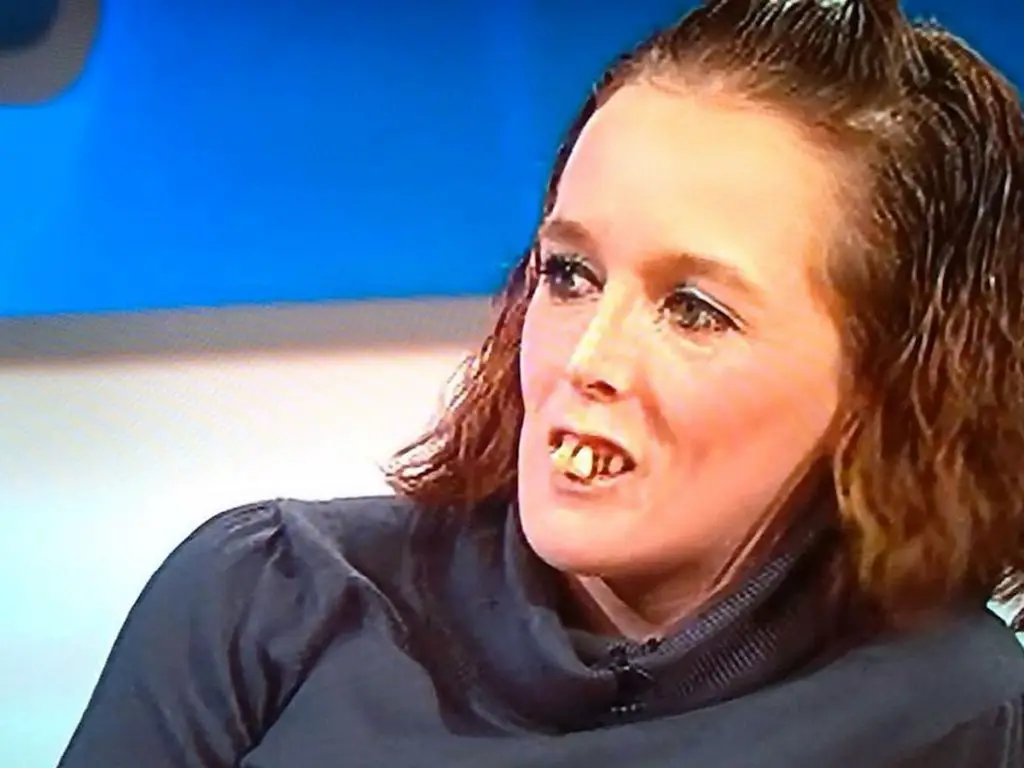 jeremy kyle teeth